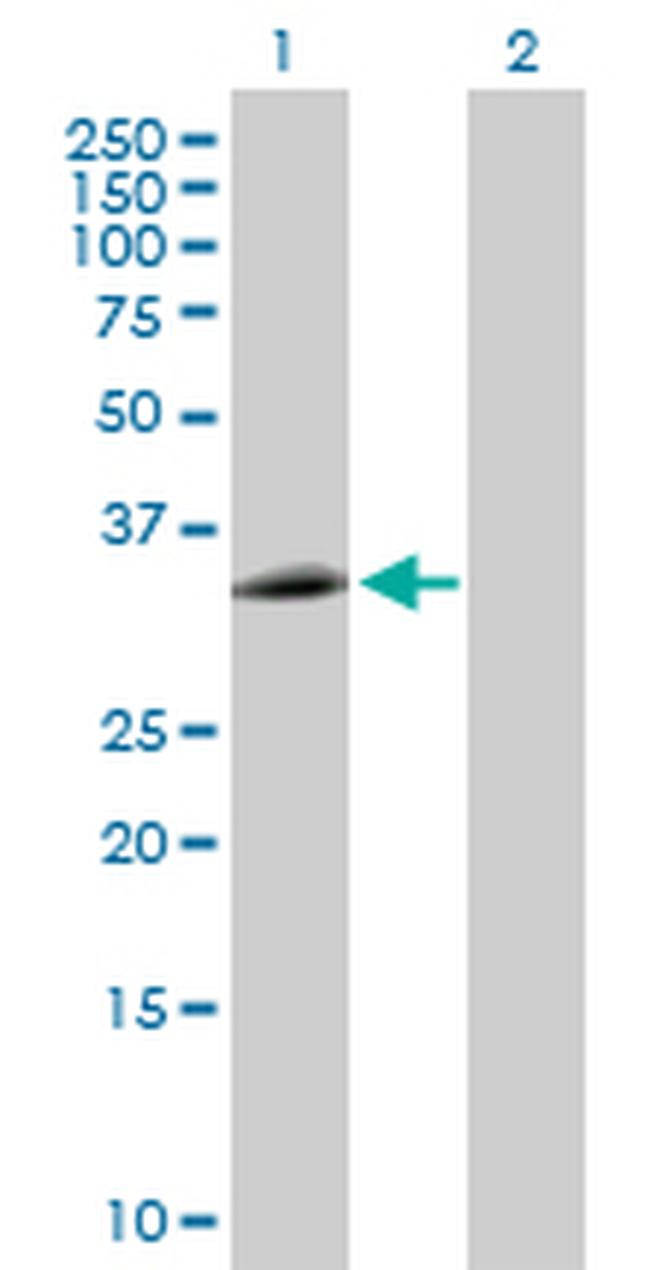 EEF1D Antibody in Western Blot (WB)