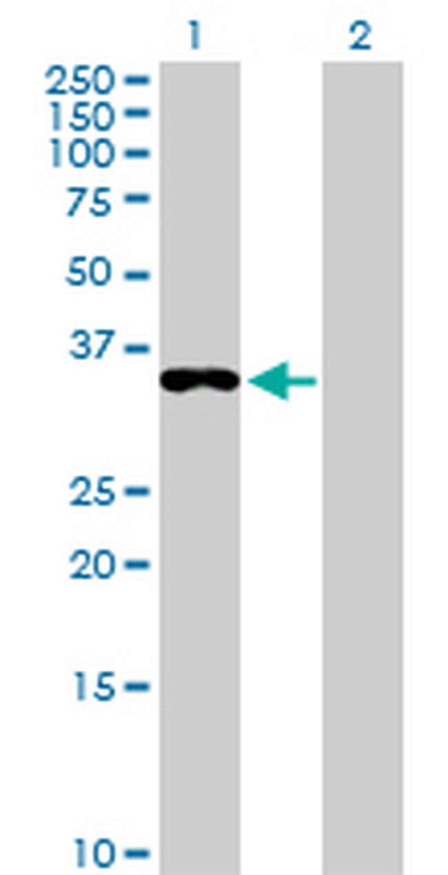 EEF1D Antibody in Western Blot (WB)