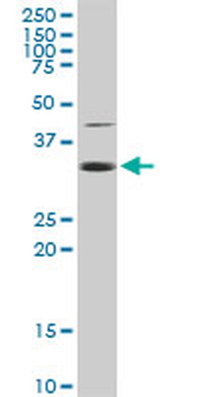 EEF1D Antibody in Western Blot (WB)