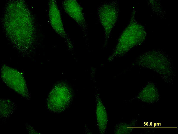 EEF1D Antibody in Immunocytochemistry (ICC/IF)