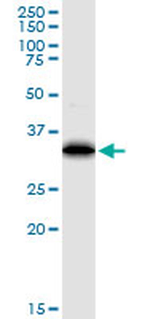 EEF1D Antibody in Western Blot (WB)