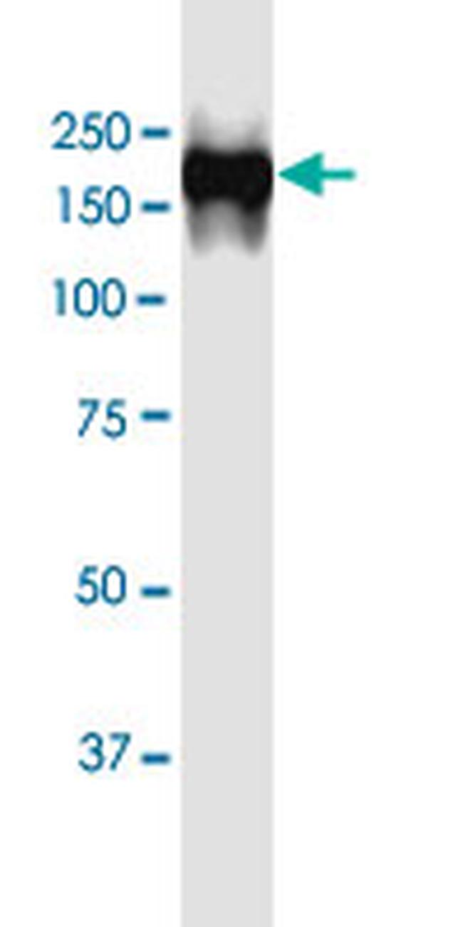 EGFR Antibody in Western Blot (WB)