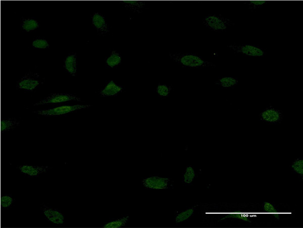 EGR1 Antibody in Immunocytochemistry (ICC/IF)