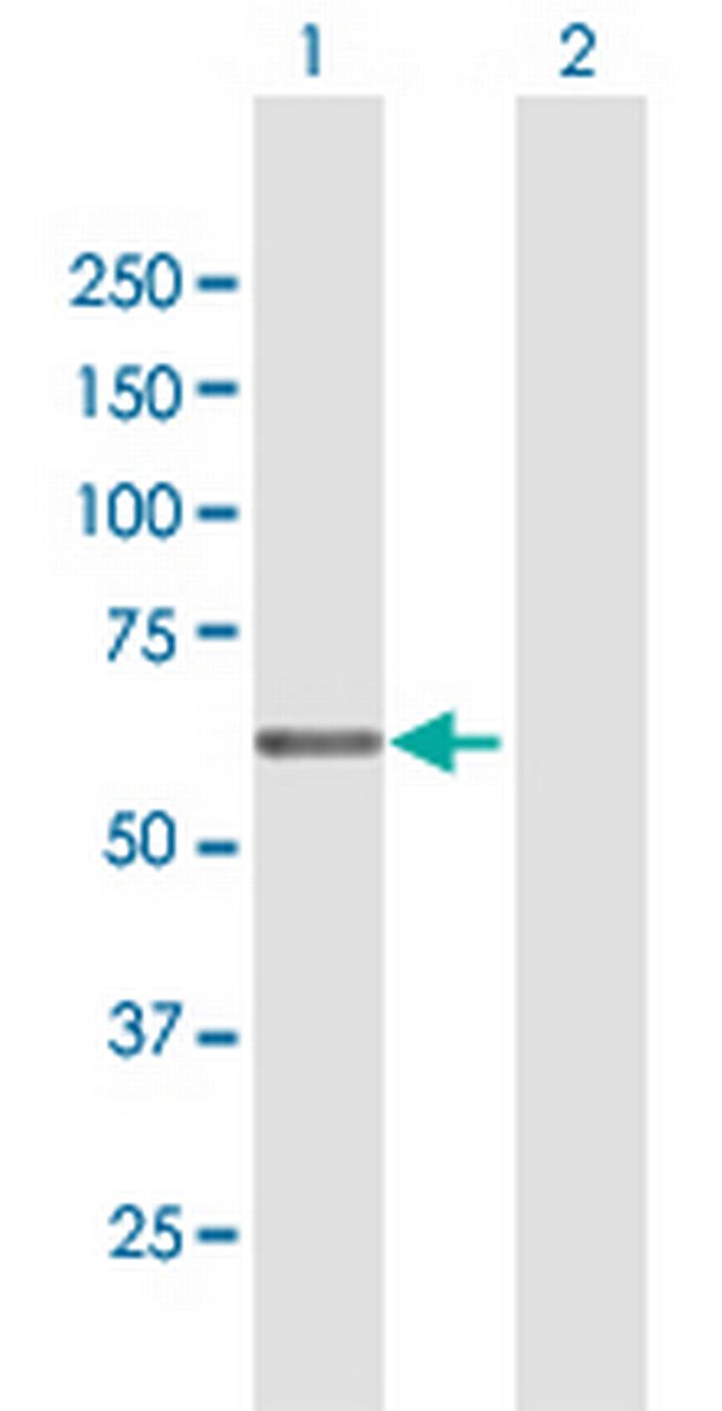 EGR2 Antibody in Western Blot (WB)