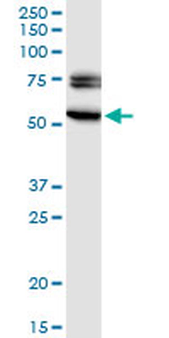 EGR2 Antibody in Western Blot (WB)