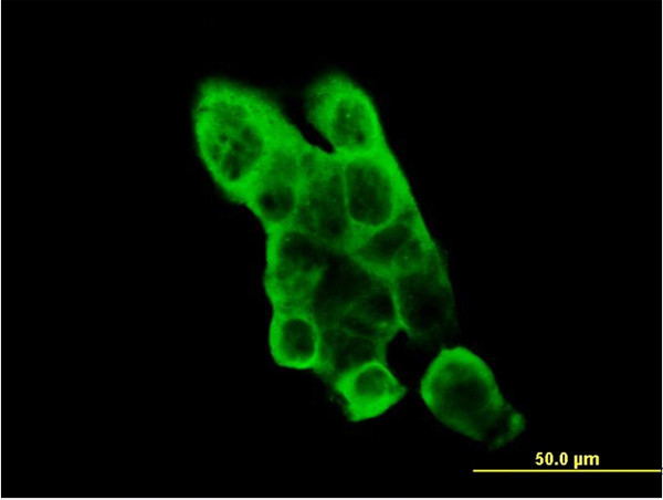 EPHA2 Antibody in Immunocytochemistry (ICC/IF)