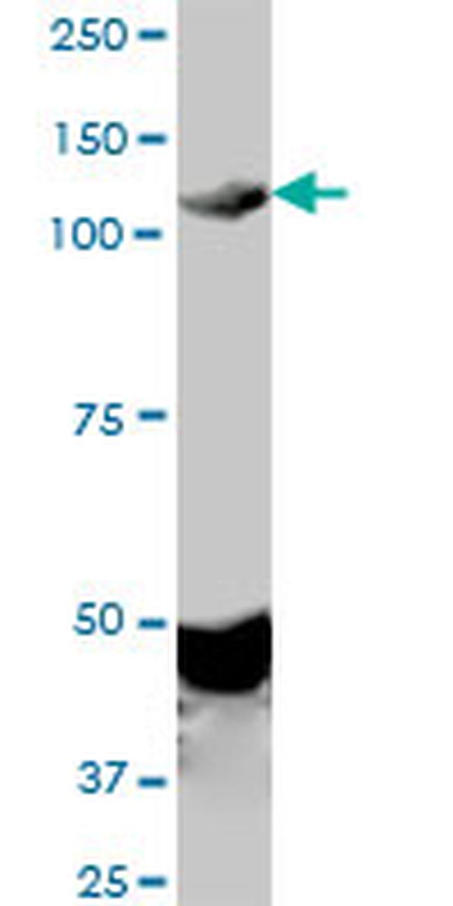 EPHA2 Antibody in Western Blot (WB)