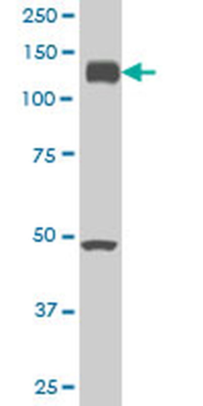 EPHA2 Antibody in Western Blot (WB)