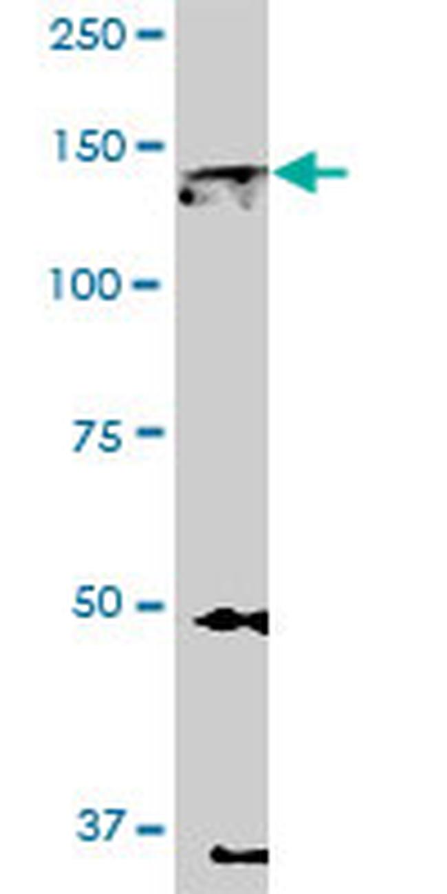 EPHA2 Antibody in Western Blot (WB)