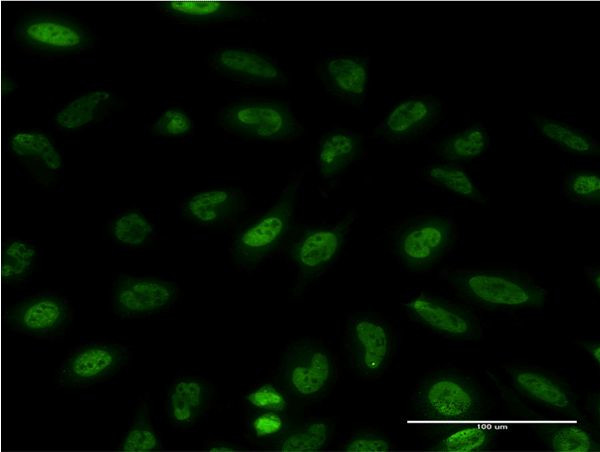 EIF4EBP1 Antibody in Immunocytochemistry (ICC/IF)