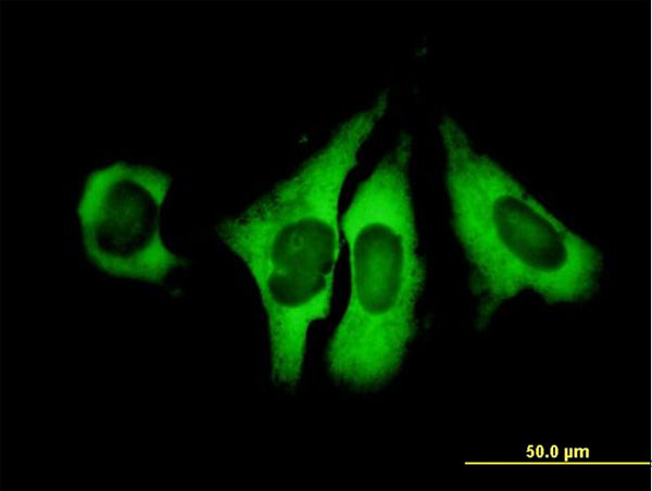 EIF4G1 Antibody in Immunocytochemistry (ICC/IF)