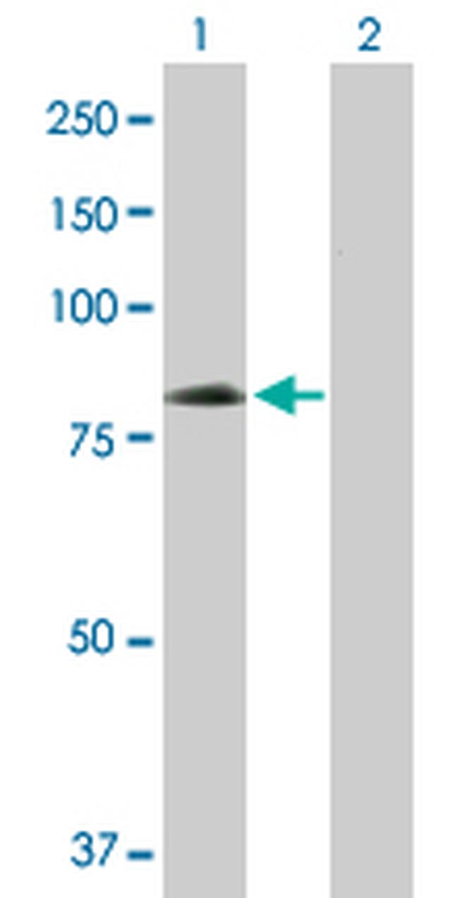 EIF4G1 Antibody in Western Blot (WB)