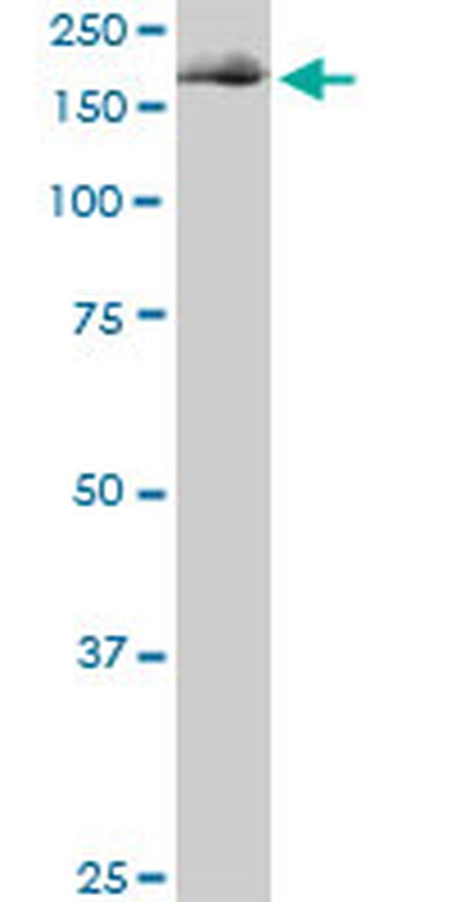 EIF4G1 Antibody in Western Blot (WB)