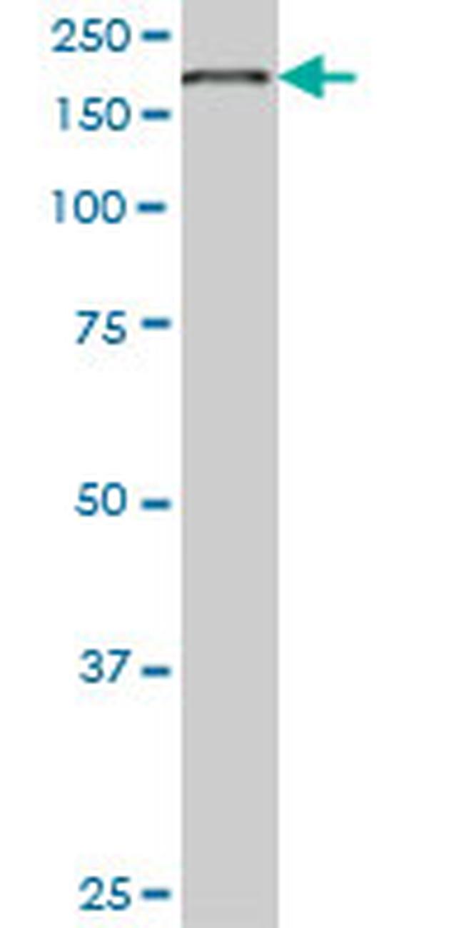 EIF4G1 Antibody in Western Blot (WB)