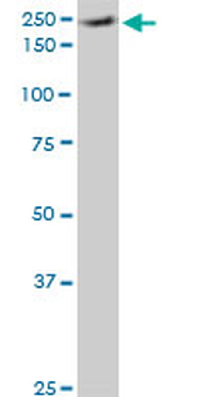 EIF4G1 Antibody in Western Blot (WB)