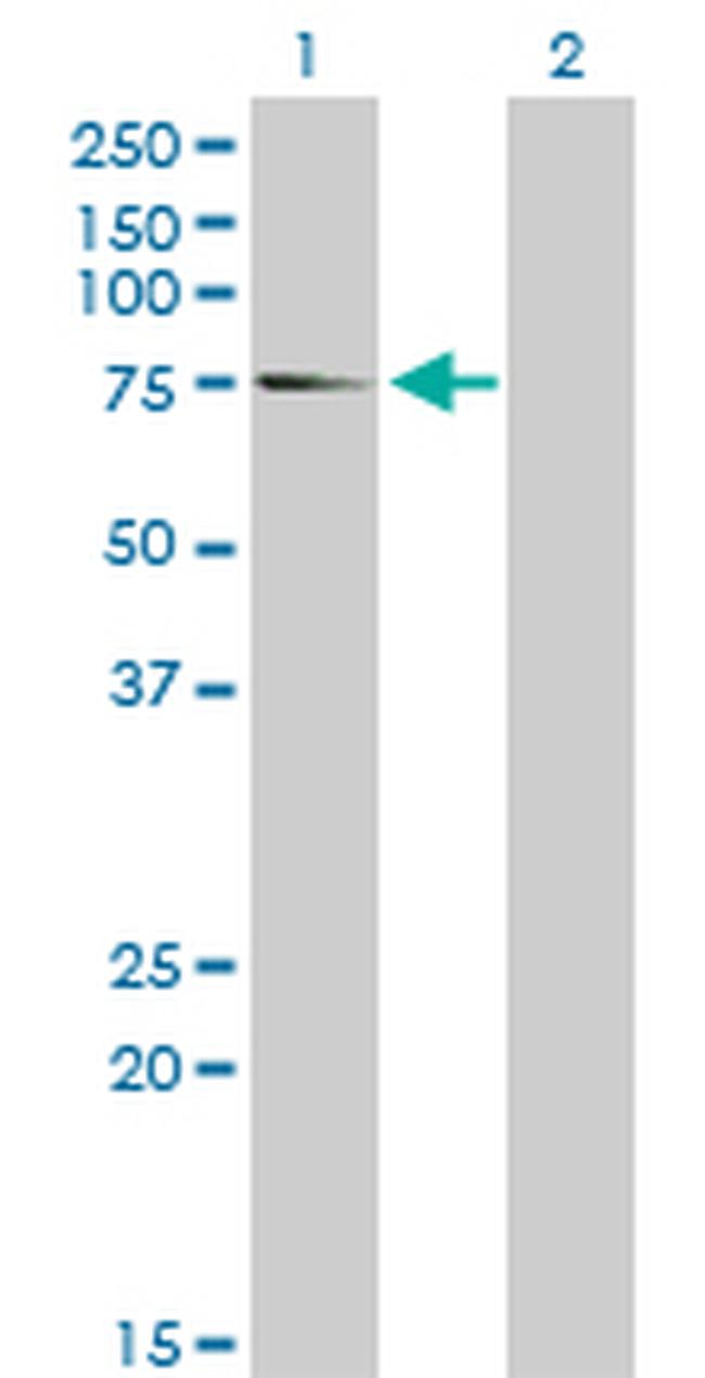 EIF4G1 Antibody in Western Blot (WB)