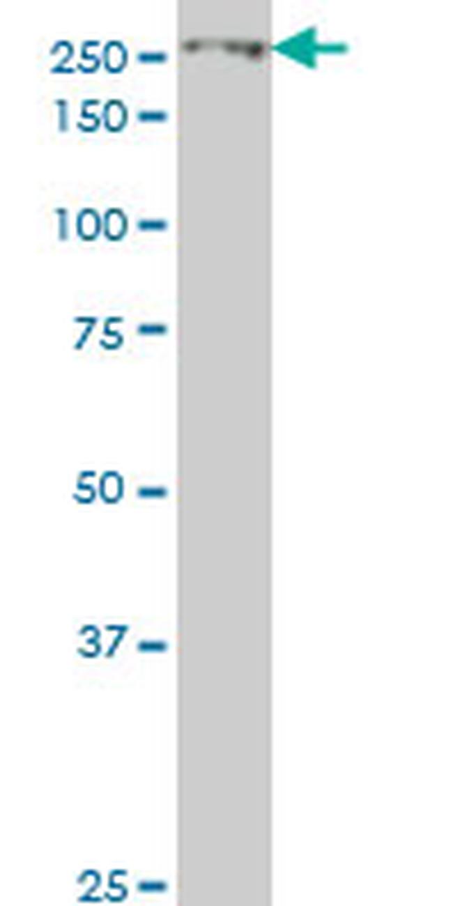 EIF4G1 Antibody in Western Blot (WB)