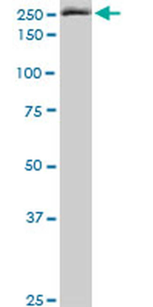 EIF4G1 Antibody in Western Blot (WB)