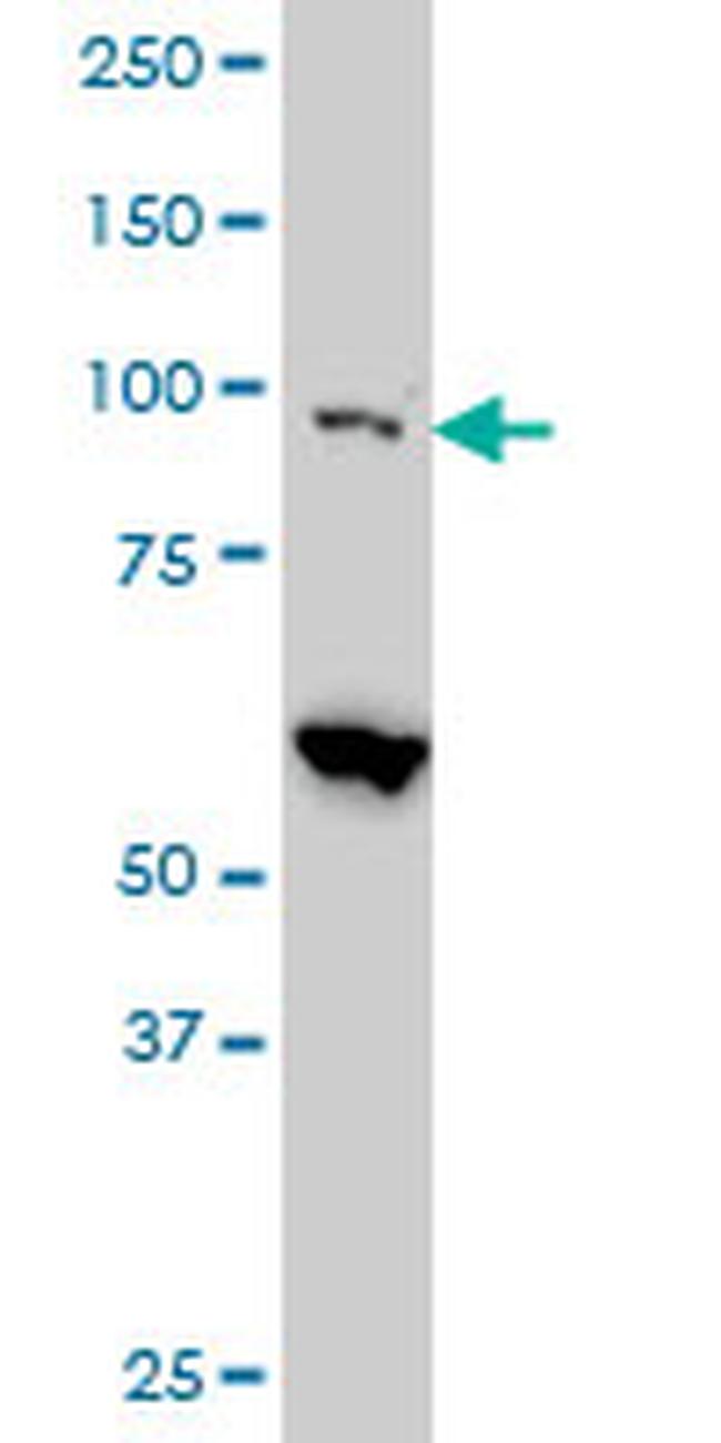 EIF4G2 Antibody in Western Blot (WB)