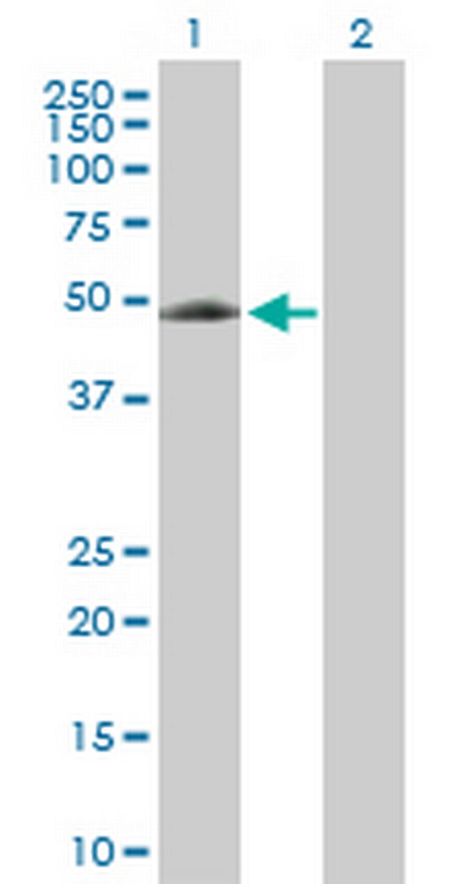 EIF5 Antibody in Western Blot (WB)