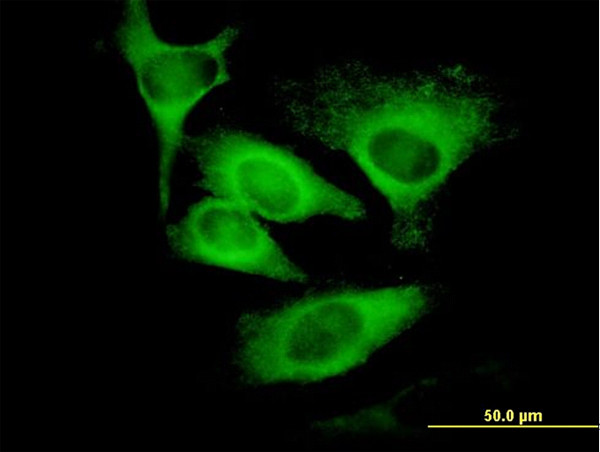 EIF5 Antibody in Immunocytochemistry (ICC/IF)