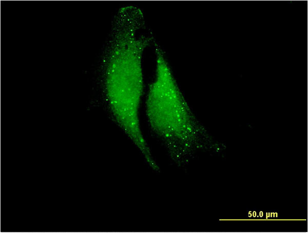 ELA1 Antibody in Immunocytochemistry (ICC/IF)