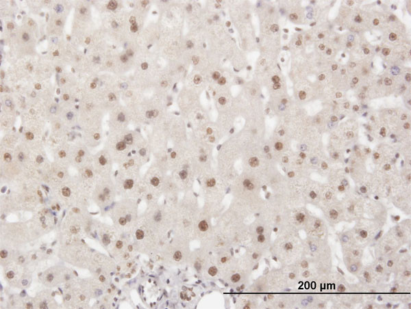 ELAVL1 Antibody in Immunohistochemistry (Paraffin) (IHC (P))