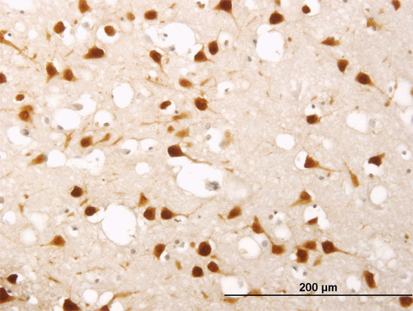 ELAVL4 Antibody in Immunohistochemistry (Paraffin) (IHC (P))