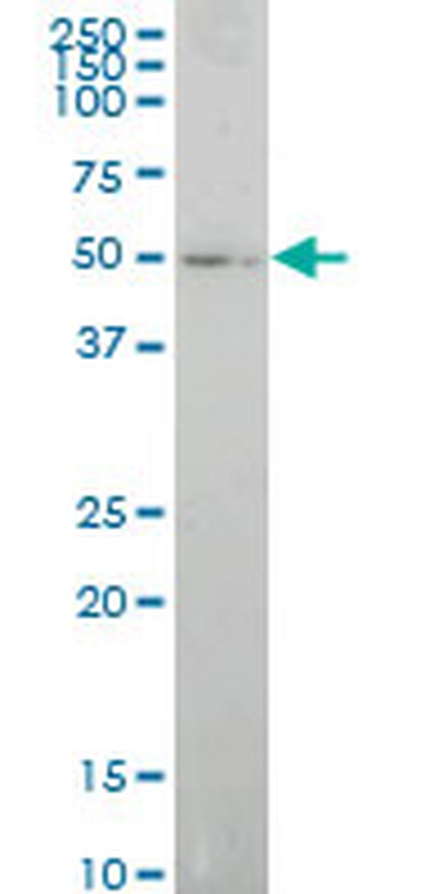 ELF1 Antibody in Western Blot (WB)