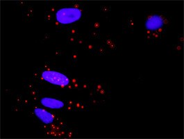 ELK1 Antibody in Proximity Ligation Assay (PLA) (PLA)