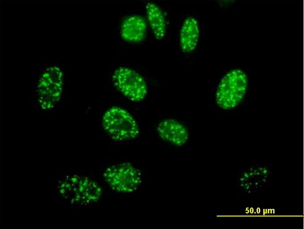 ELK4 Antibody in Immunocytochemistry (ICC/IF)