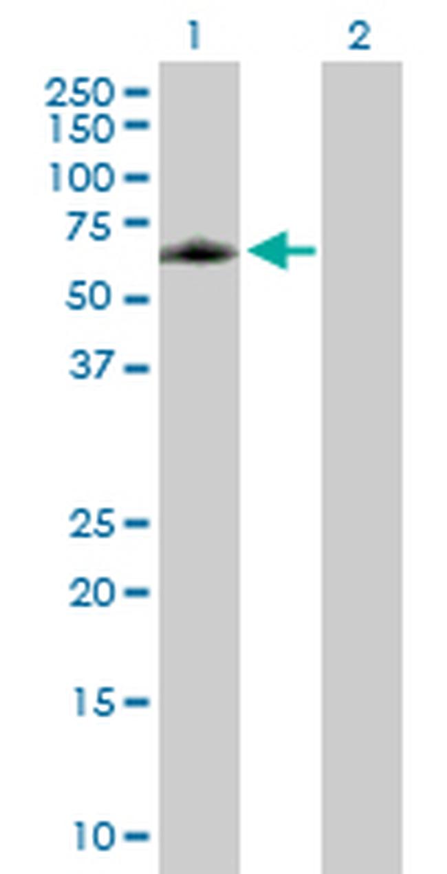 ELK4 Antibody in Western Blot (WB)