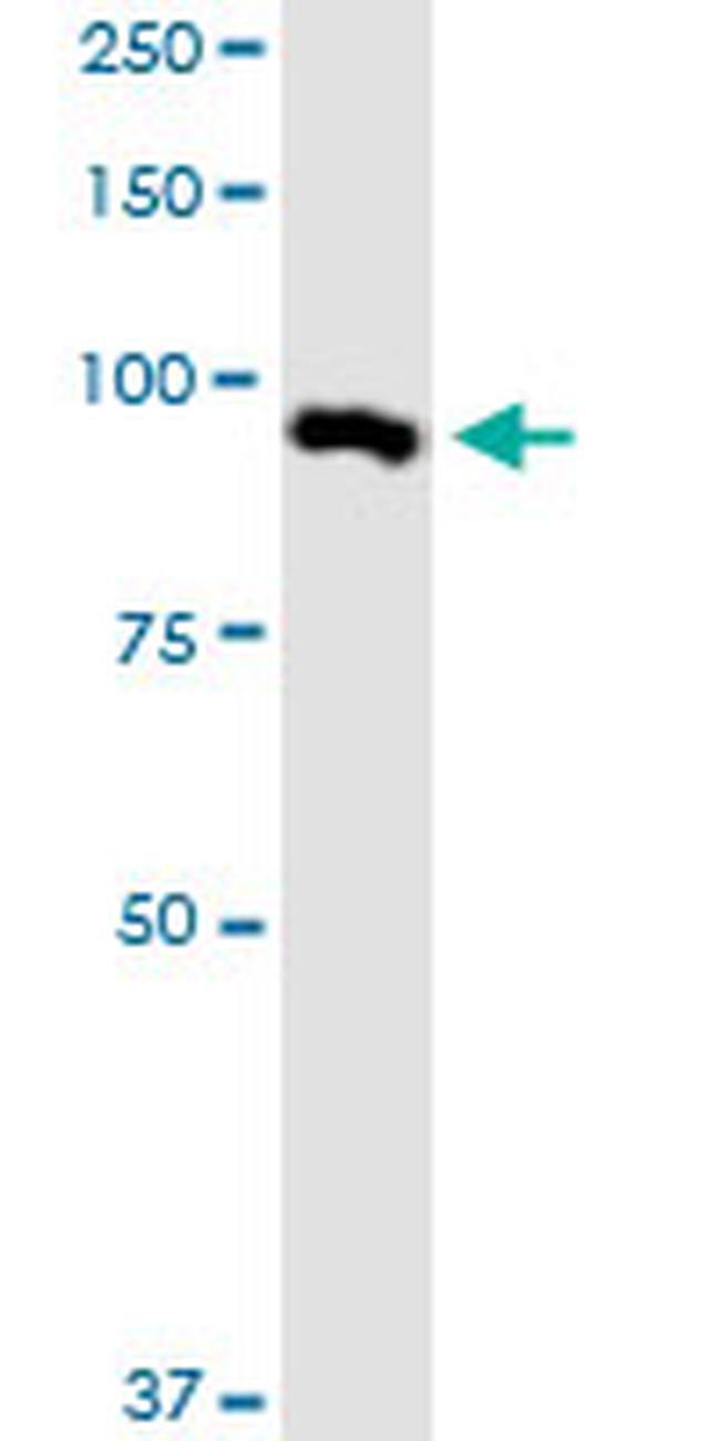 MARK2 Antibody in Western Blot (WB)