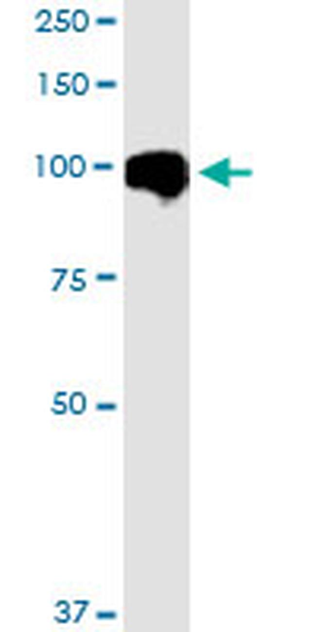 MARK2 Antibody in Western Blot (WB)