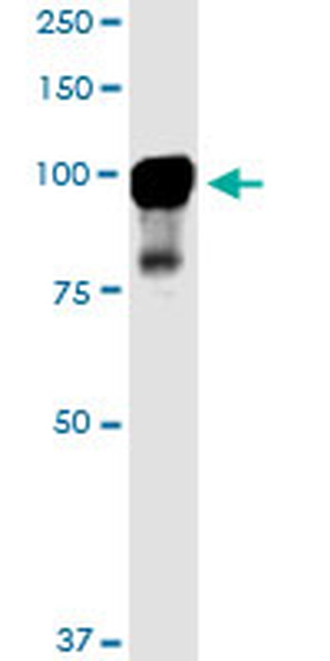 MARK2 Antibody in Western Blot (WB)