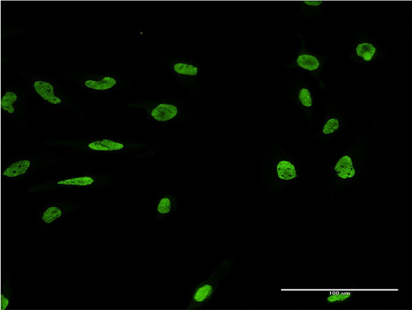 MARK2 Antibody in Immunocytochemistry (ICC/IF)