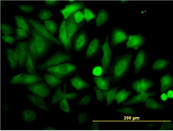 ENO1 Antibody in Immunocytochemistry (ICC/IF)