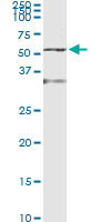 ENO1 Antibody in Immunoprecipitation (IP)