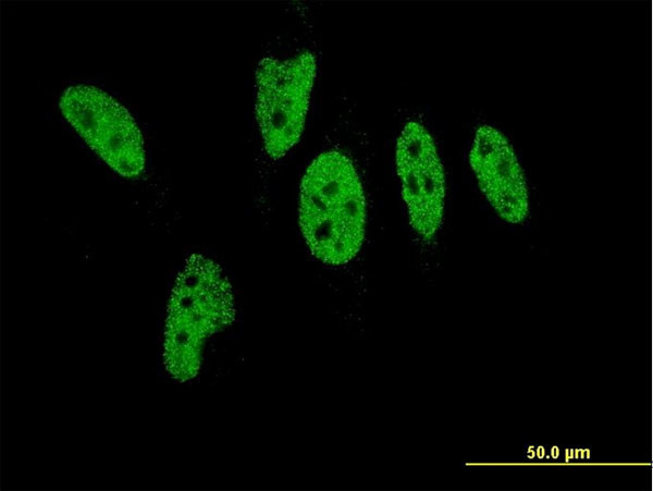 EP300 Antibody in Immunocytochemistry (ICC/IF)