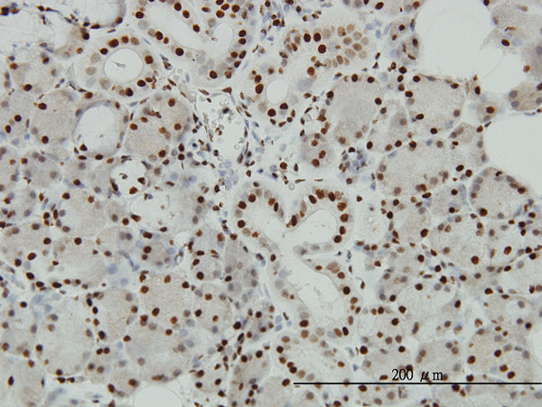 EP300 Antibody in Immunohistochemistry (Paraffin) (IHC (P))