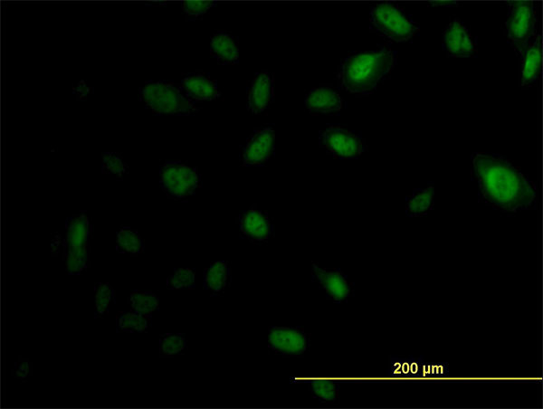 EP300 Antibody in Immunocytochemistry (ICC/IF)