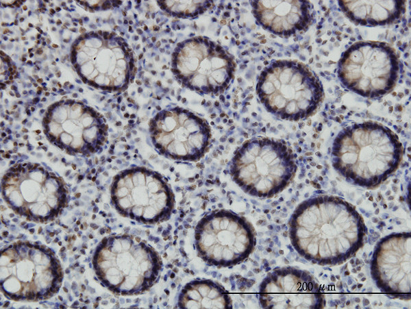 EP300 Antibody in Immunohistochemistry (Paraffin) (IHC (P))