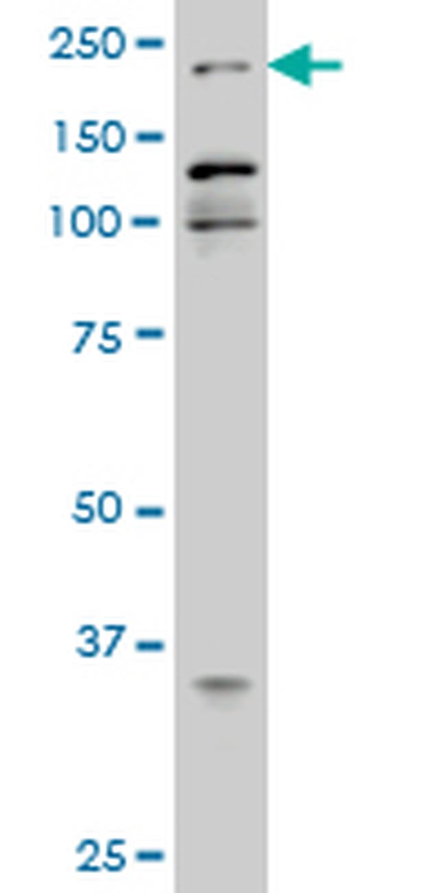 EP300 Antibody in Western Blot (WB)