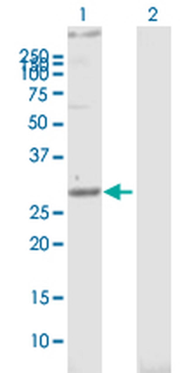 STOM Antibody in Western Blot (WB)