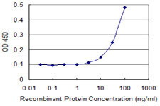 EPHB2 Antibody in ELISA (ELISA)