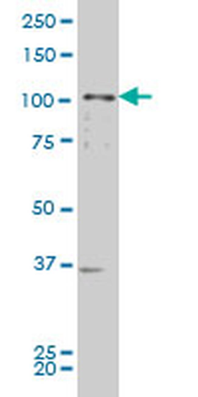 EPHB2 Antibody in Western Blot (WB)