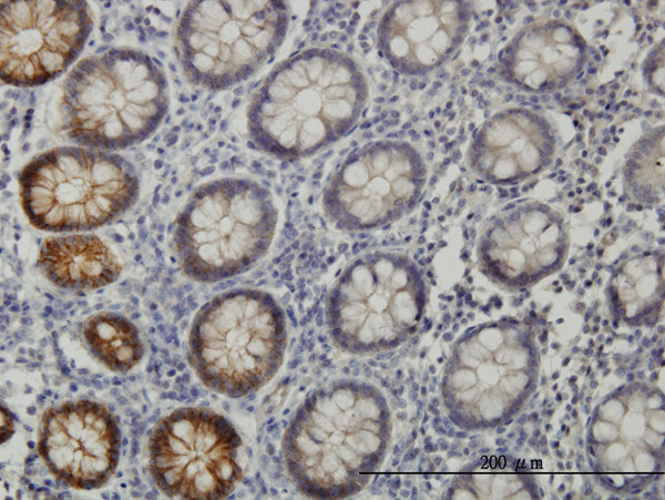 EPHB3 Antibody in Immunohistochemistry (Paraffin) (IHC (P))