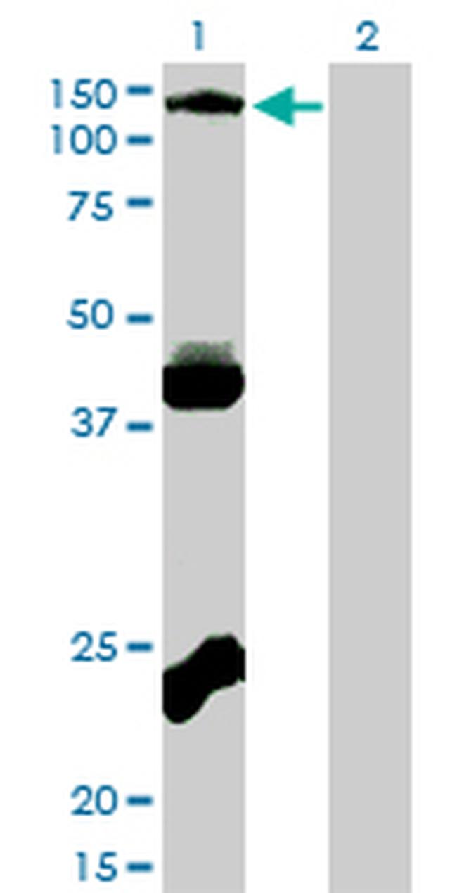 EPHB3 Antibody in Western Blot (WB)