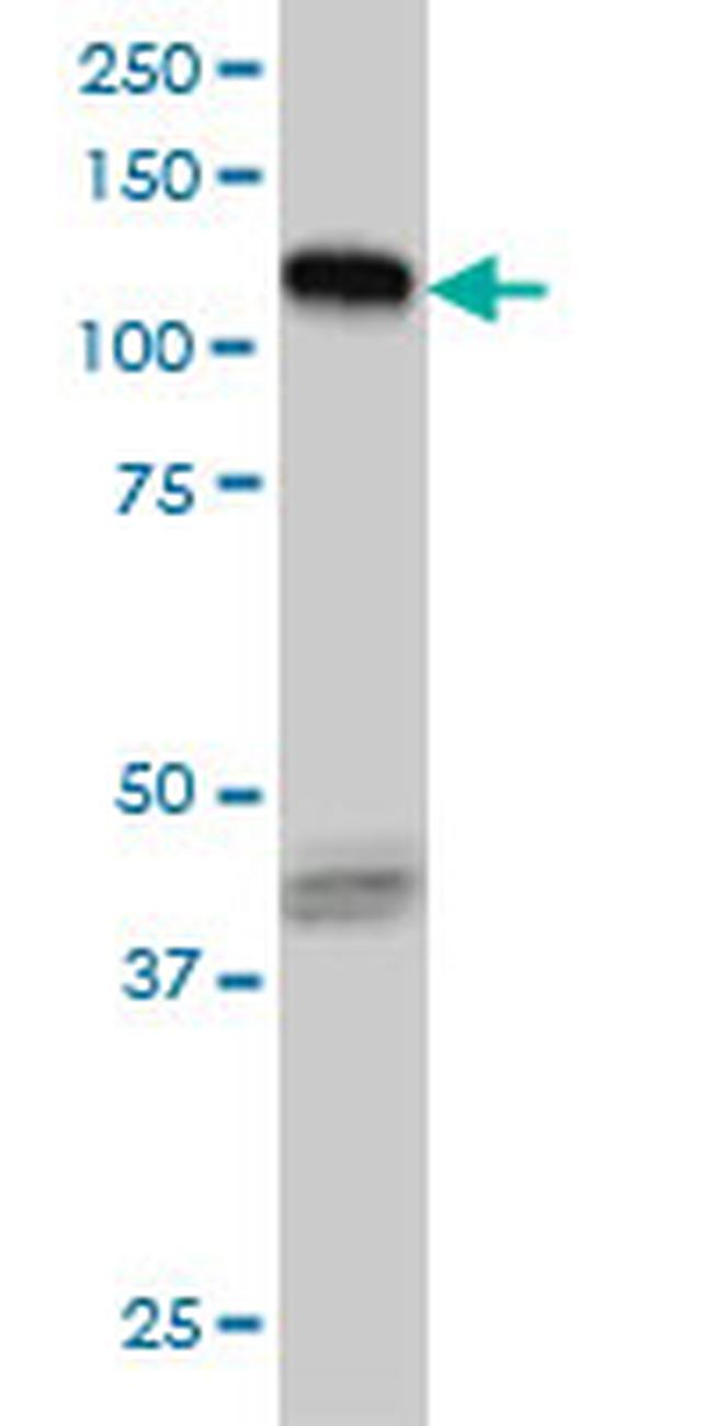 EPHB3 Antibody in Western Blot (WB)