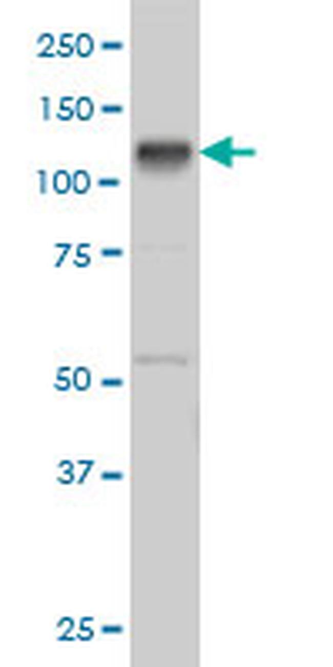 EPHB3 Antibody in Western Blot (WB)